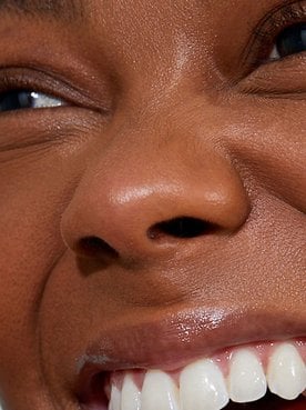 Hyaluronic Acid Under Eyes
