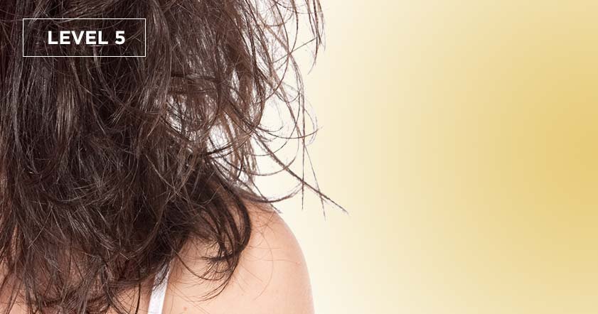 Loreal Paris BMAG Slideshow How Damaged Is Your Hair SLIDE 7 D