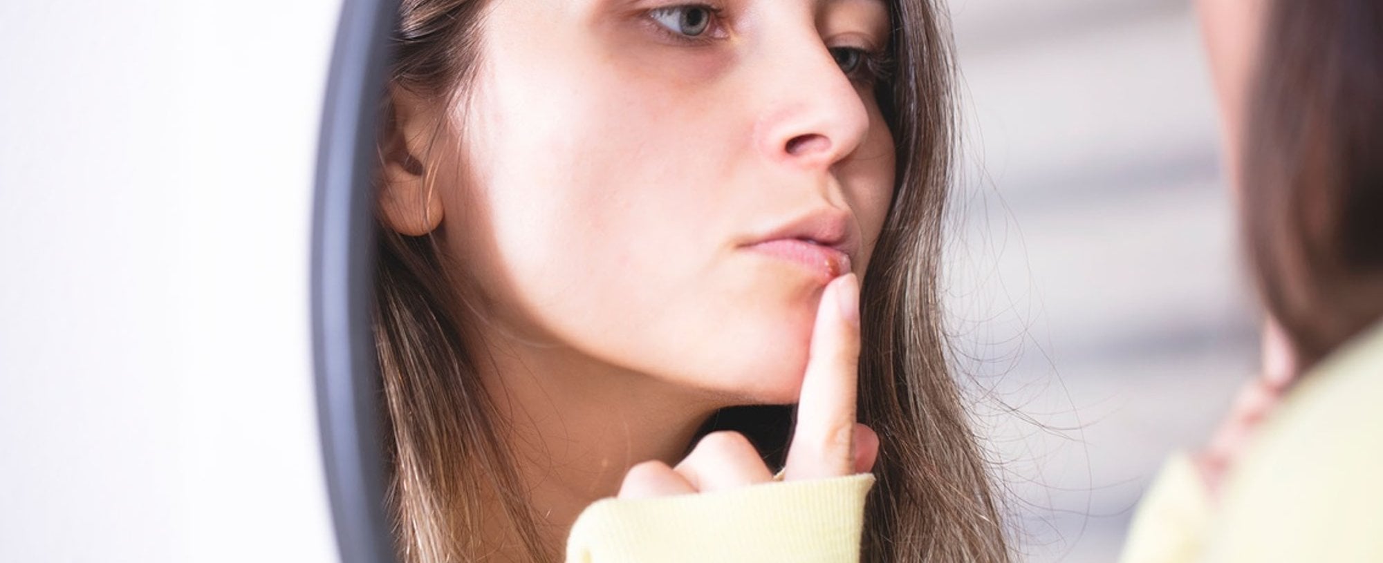 How To Cover Up A Cold Sore