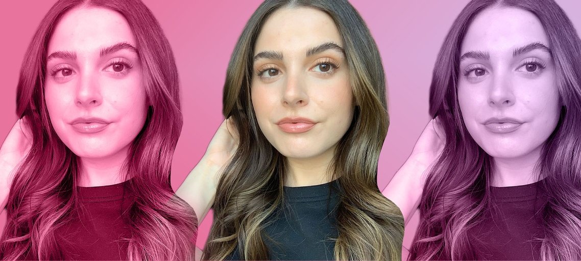 Lip Contouring