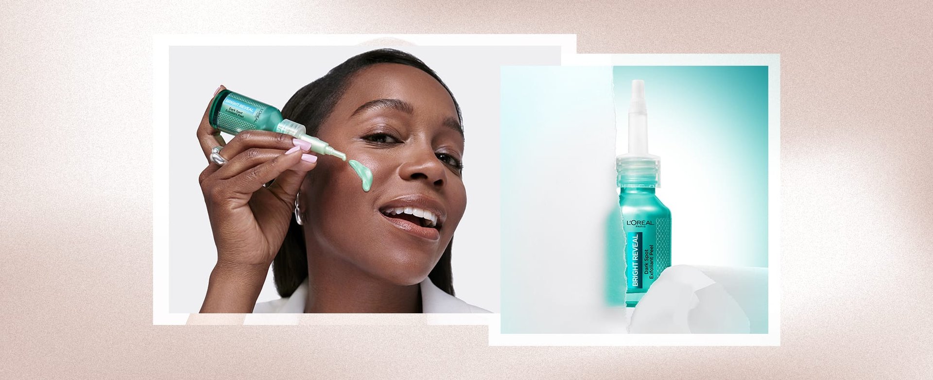 Banner What Is A Chemical Peel Desktop