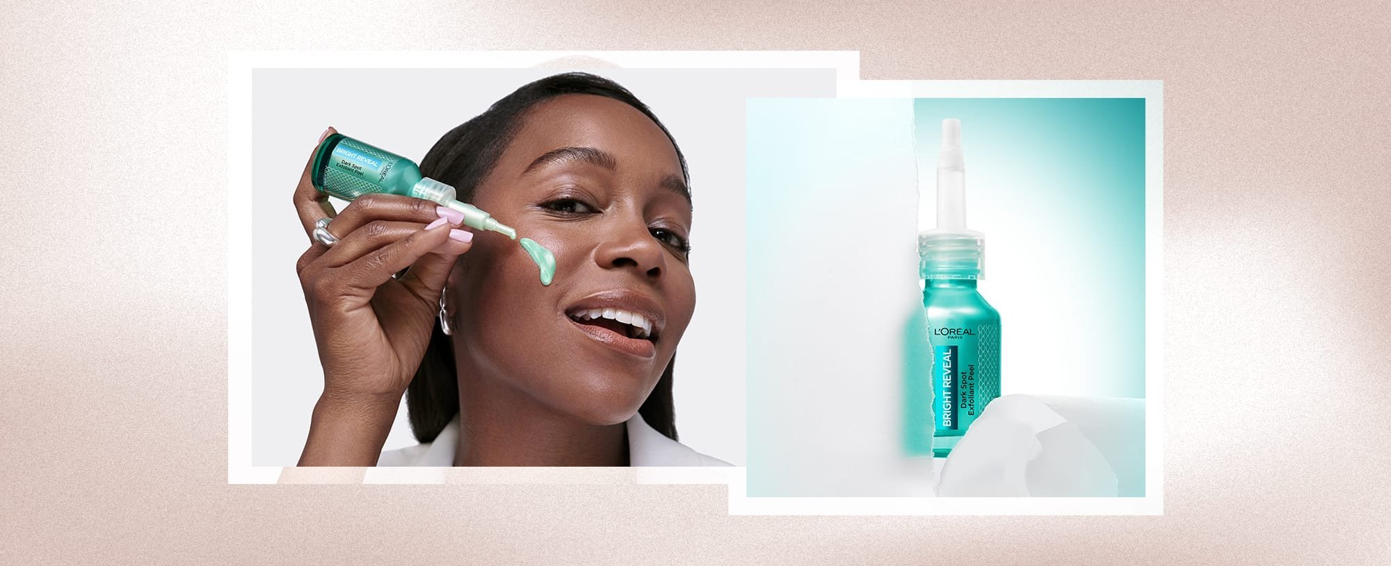 Banner What Is A Chemical Peel Desktop