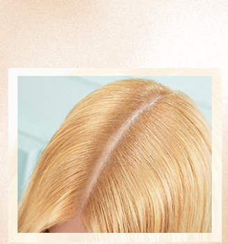 Banner Dandruff Causes And Treatment Tips Mobile