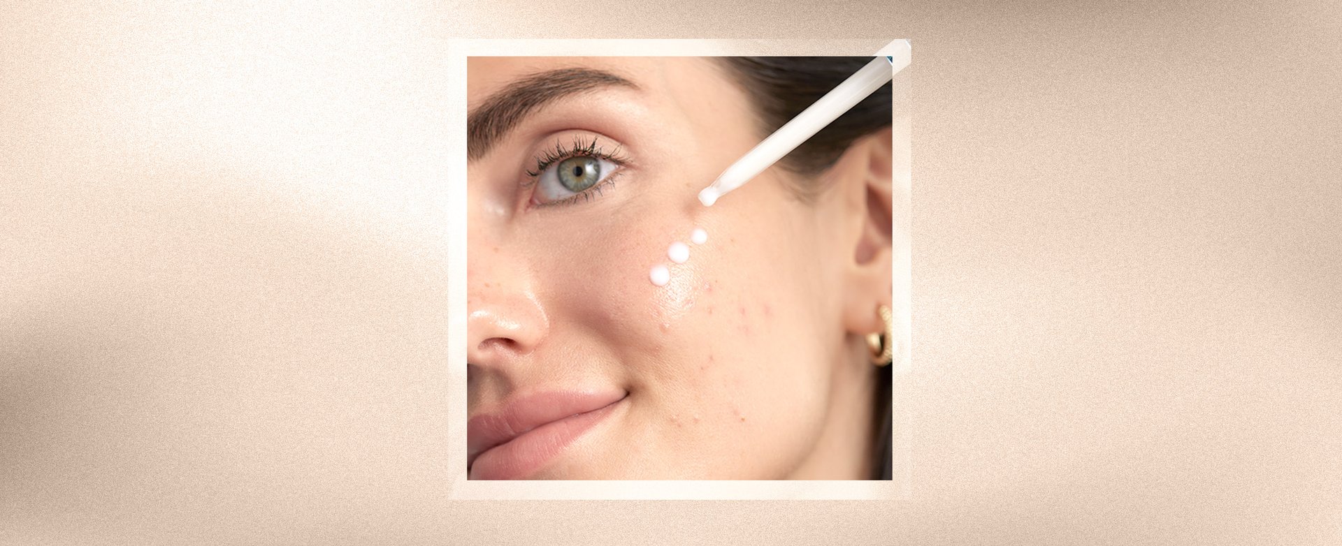 Banner-alpha-hydroxy-acids-AHAs-desktop