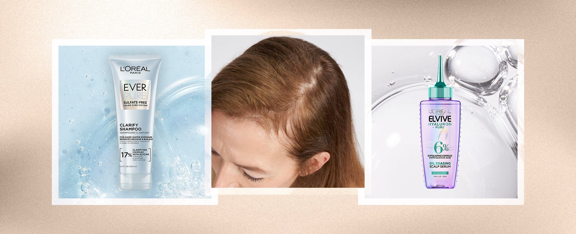 Banner-what-is-scalp-psoriasis-desktop