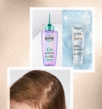 Banner-what-is-scalp-psoriasis-mobile