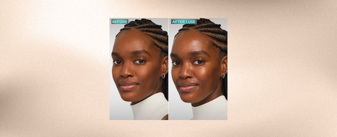 Translucent Ruddy Skin What Causes a Ruddy Complexion and What Can You Do About It? | L’Oréal ...