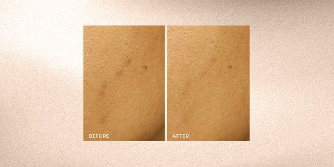 Best Skincare for Aging Skin & Tips for Your Routine | L’Oréal Paris