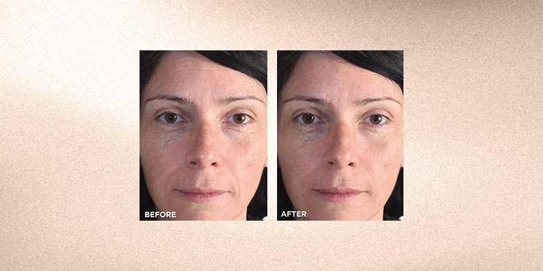 Best Skincare for Aging Skin & Tips for Your Routine | L’Oréal Paris