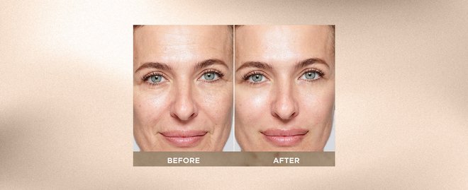 How To Choose the Best Anti-Aging Cream for Your Skincare Routine | L ...
