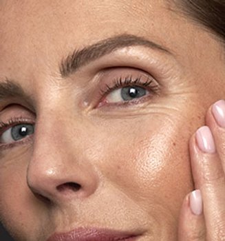 Banner-dry-skin-around-and-under-eyes-mobile