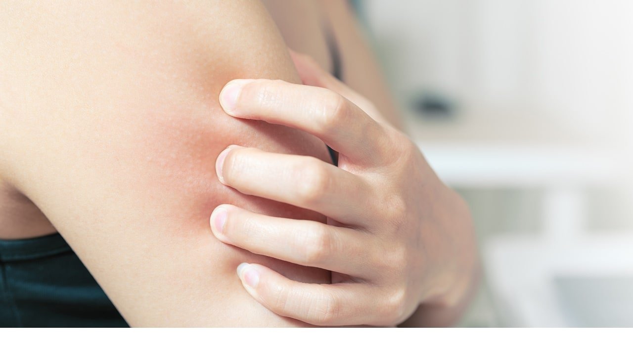 Loreal Paris BMAG Article What Causes Eczema D