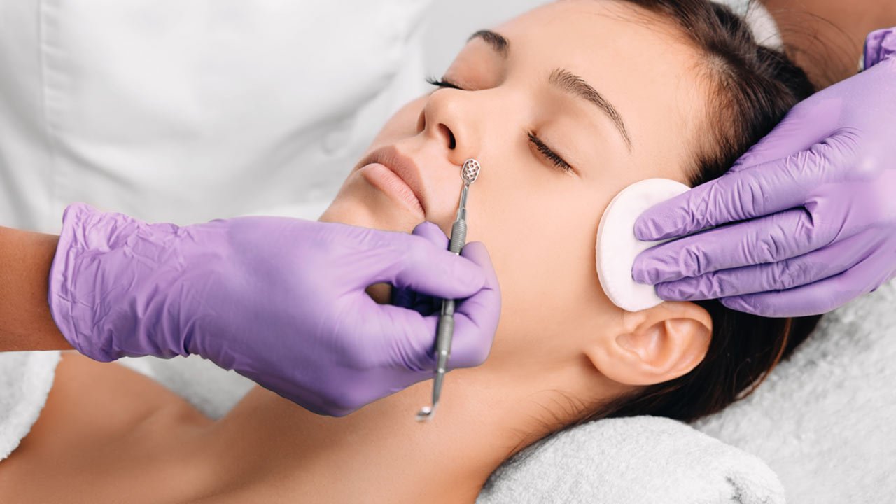 Loreal Paris BMAG Article What You Should Know About Blackhead Extraction D