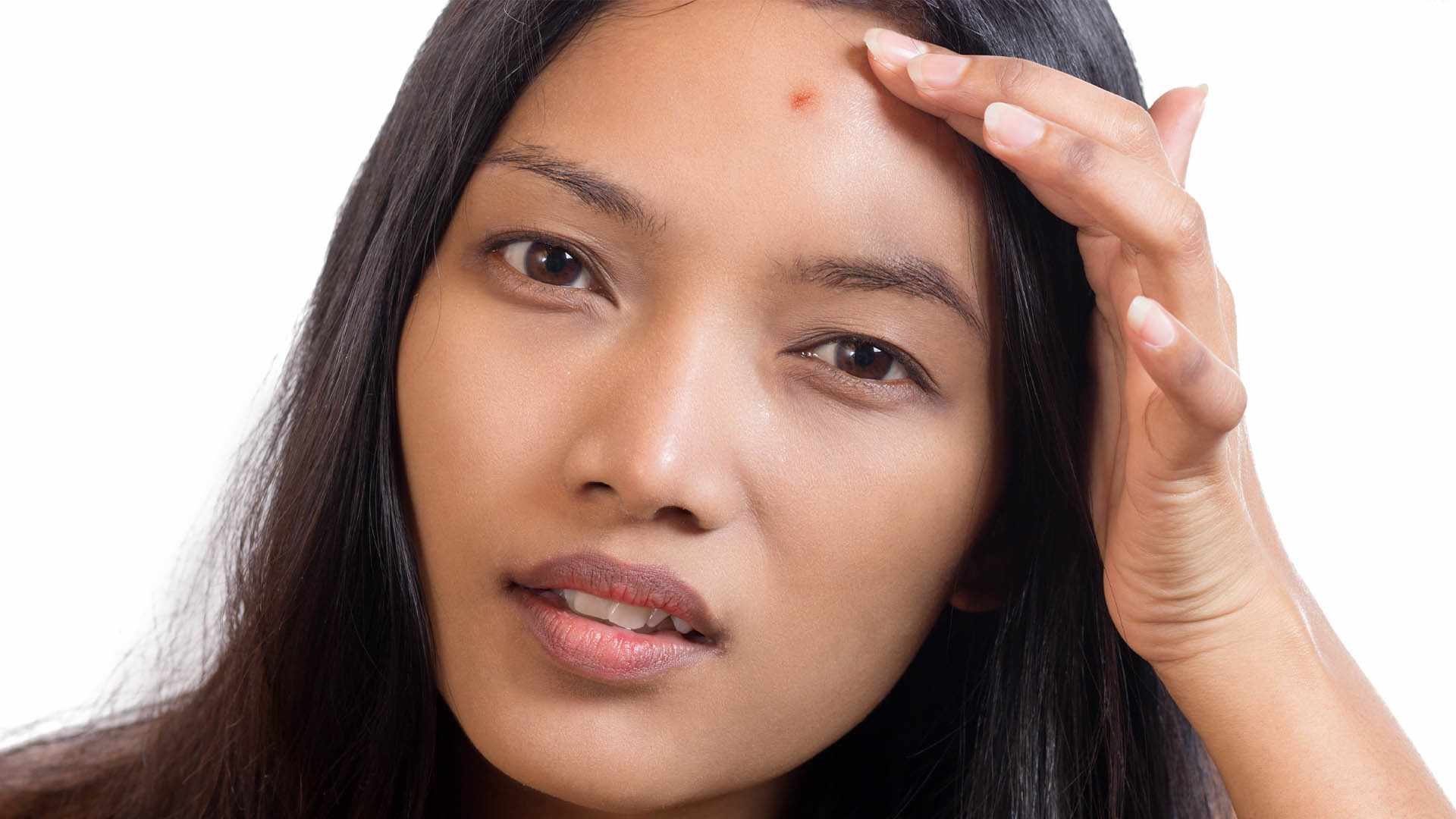 Loreal Paris Article Are Your Hair Products Making You Breakout D