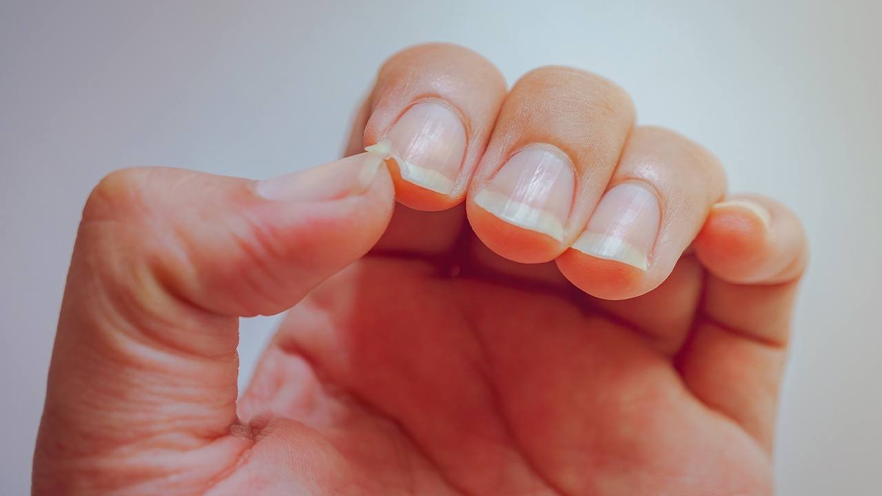 How to Fix a Broken Nail at Home L’Oréal Paris