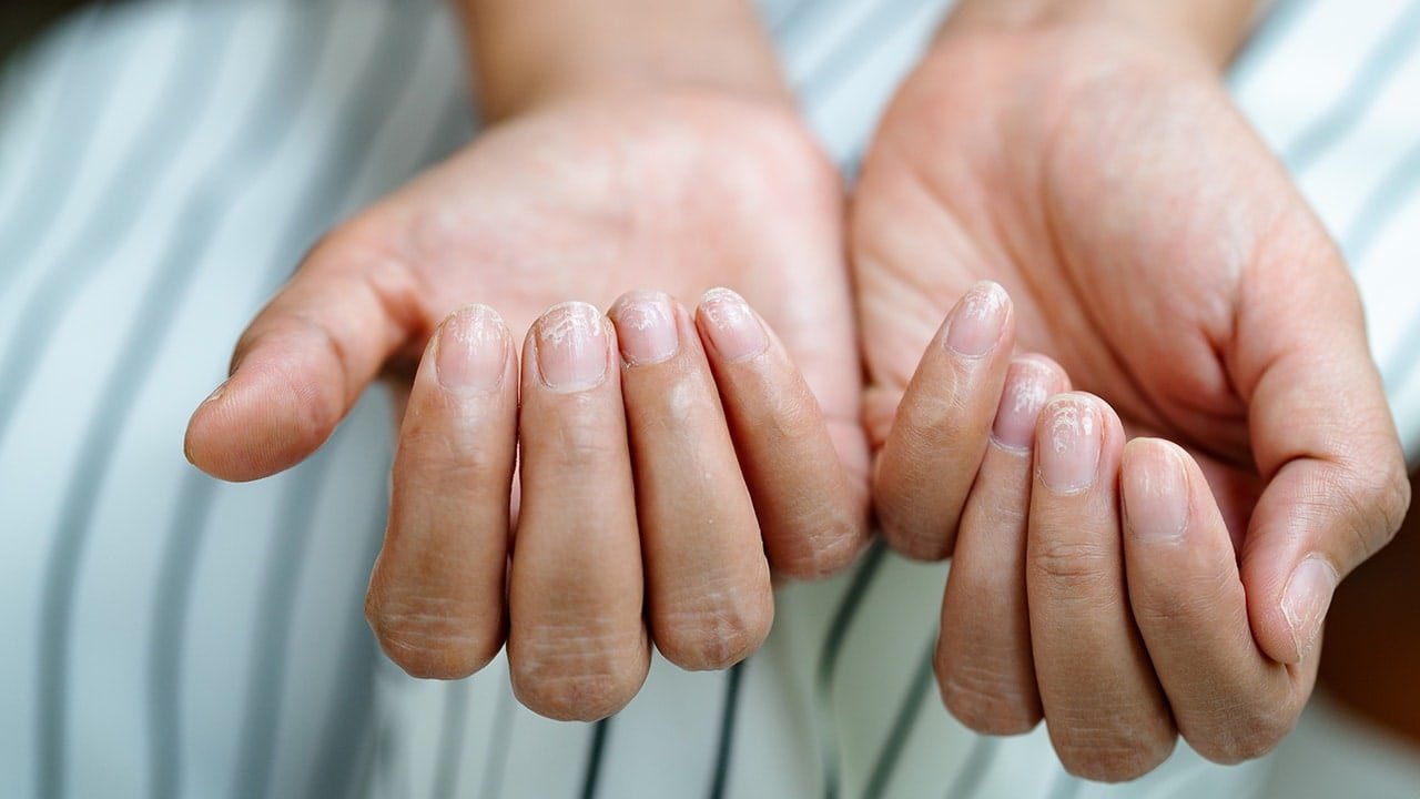 Loreal Paris BMAG Article What Do White Spots On Your Nails Mean D