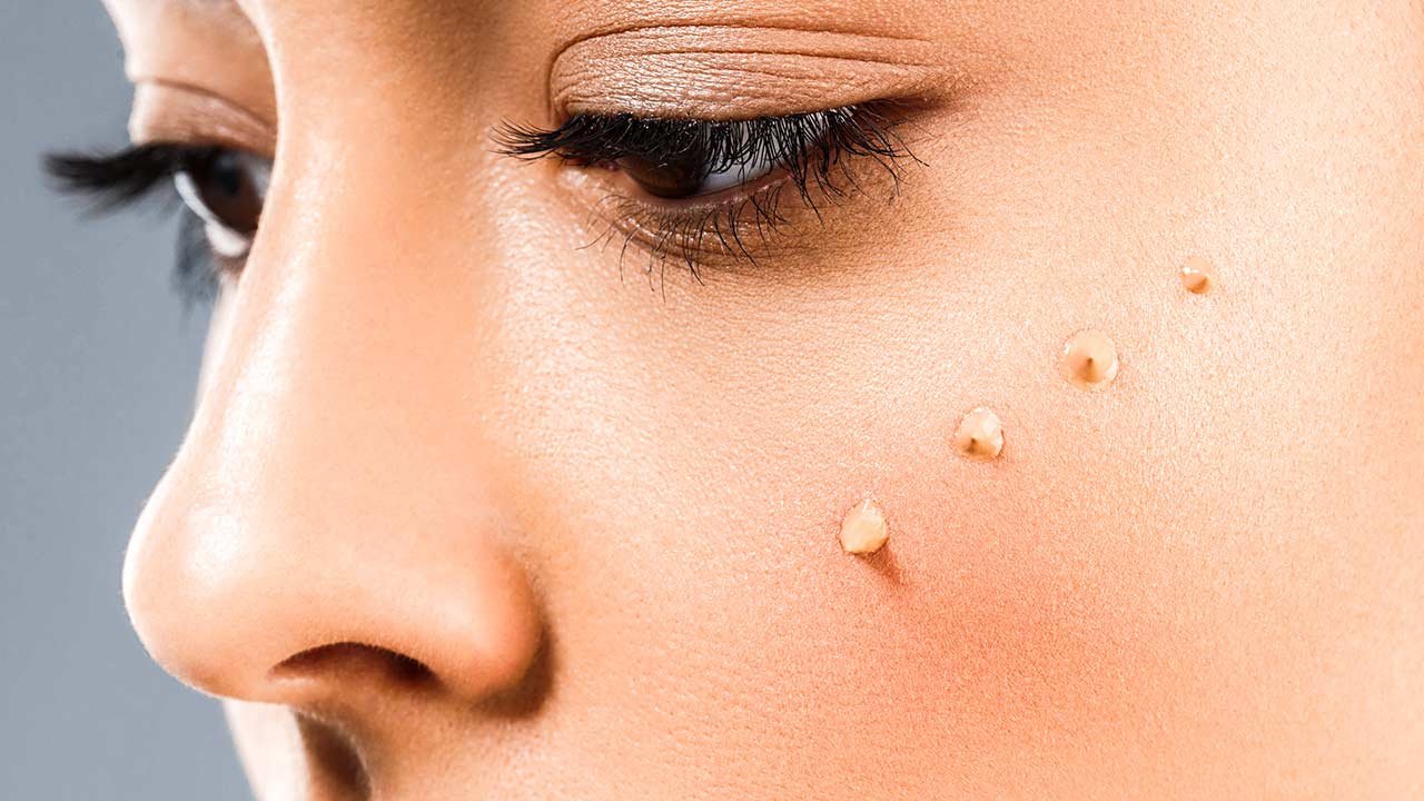 4 Amazing Concealers For Dark Spots L’Oréal Paris