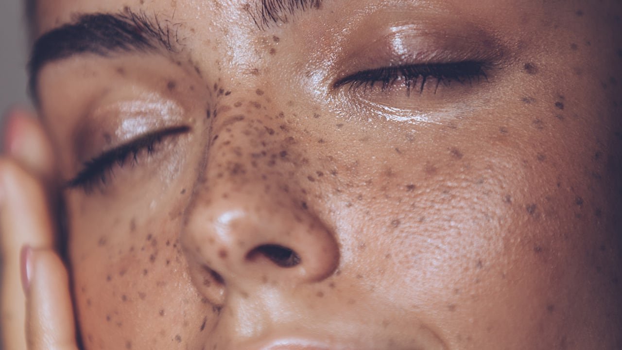 Loreal Paris BMAG Article 8 Reasons You Might Have Oily Skin D