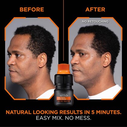0929 LOR21 Men Expert Hair Color Ecomm ATF Before After R5 Shade 01