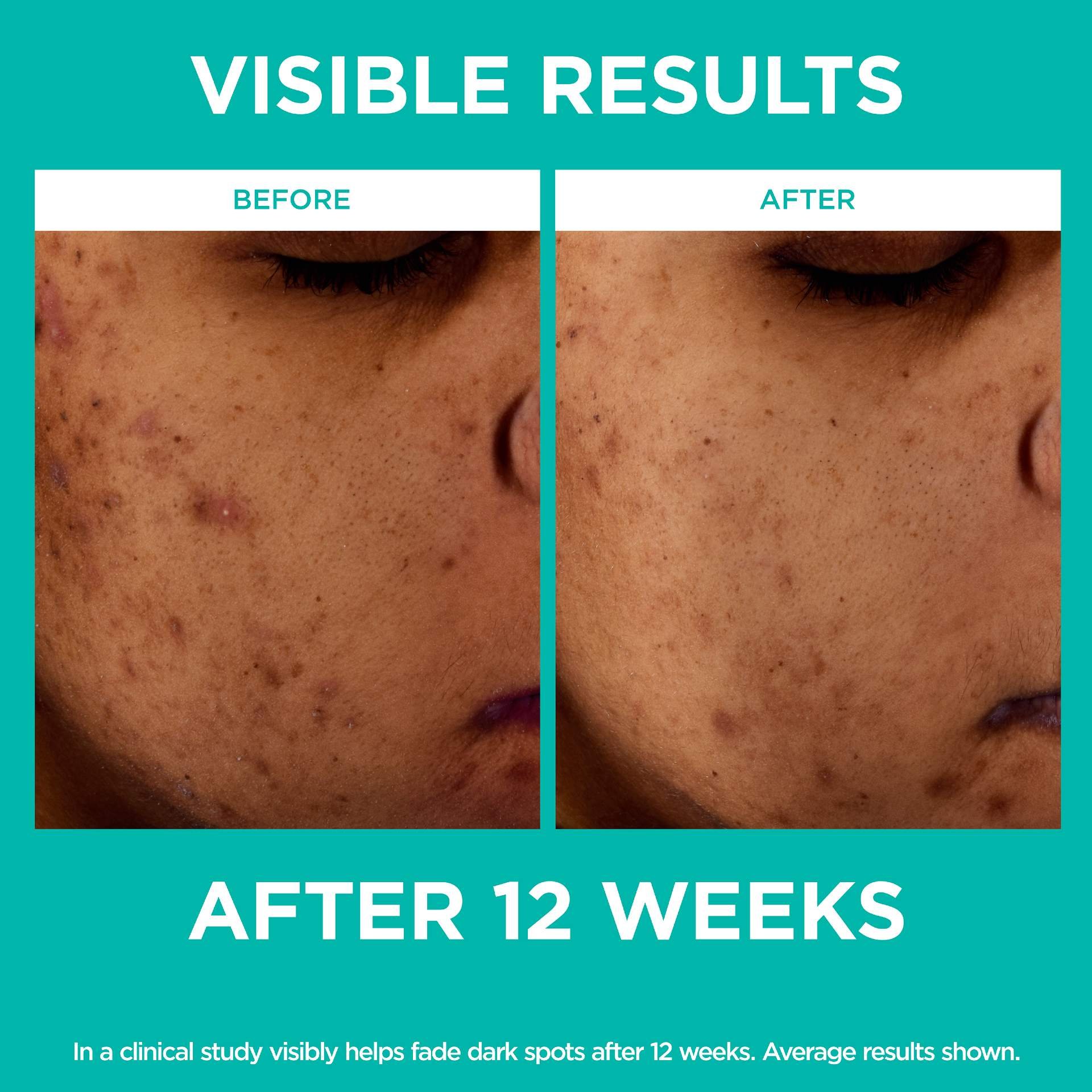 Bright Reveal 12 [Niacinamide + Amino Sulfonic + Ferulic Acid] Dark