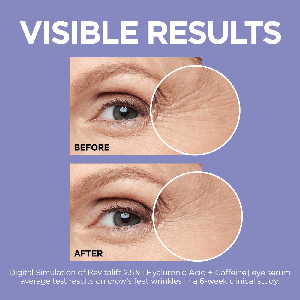 Revitalift Hyaluronic Acid & Caffeine Eye Serum L'Oréal Paris